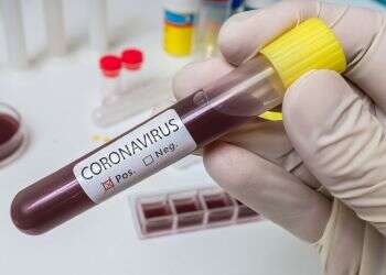 Number of coronavirus patients in Israel exceeds 100