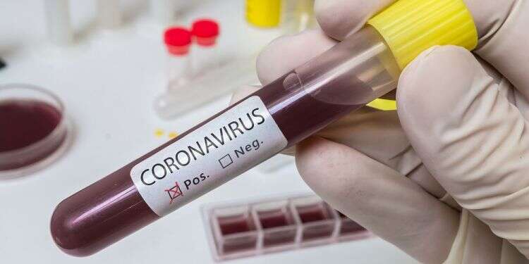 Number of coronavirus patients in Israel exceeds 100