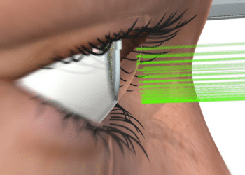 Israeli startup edges closer to 1-second glaucoma treatment