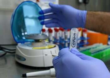 Forged coronavirus tests likely to wreak havoc in Jerusalem