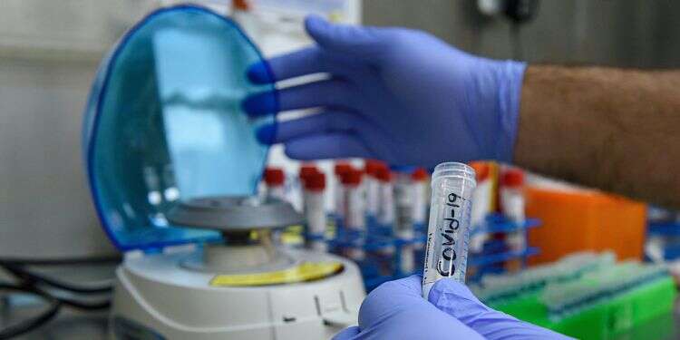 Forged coronavirus tests likely to wreak havoc in Jerusalem