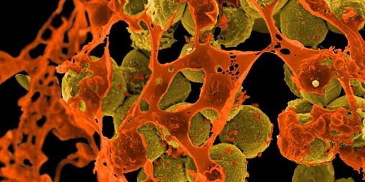 BGU tech transfer arm announces new way of identifying antibiotics resistance