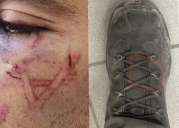 Police deny imprinting Star of David on Palestinian arrestee's face